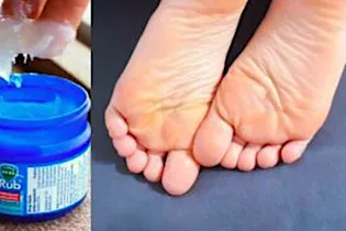 Rub Vicks VapoRub On Your Feet At Night, Here's Why