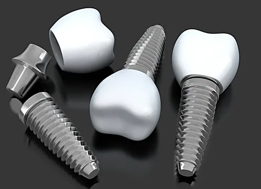 Dental implants in Turkey: See options