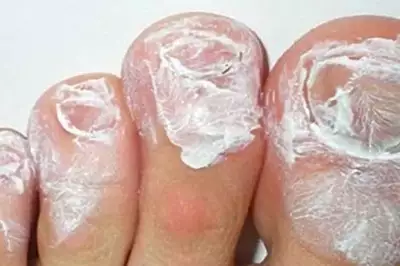 يجب أن يعرف الجميع عن خدعة معجون الأسنان هذه