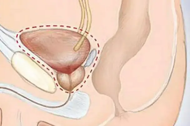 Top US Men's Surgeon: Do This Once Daily To 'Shrink' an Enlarged Prostate