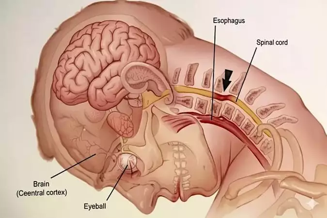 El error número 1 que cometen las personas con dolor crónico de cuello por la noche