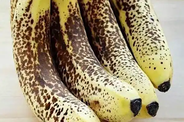 Αν πάσχετε από κιρσούς, διαβάστε αυτό