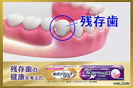 これ以上歯を失いたくない！残存歯の健康を考えた入れ歯安定剤！