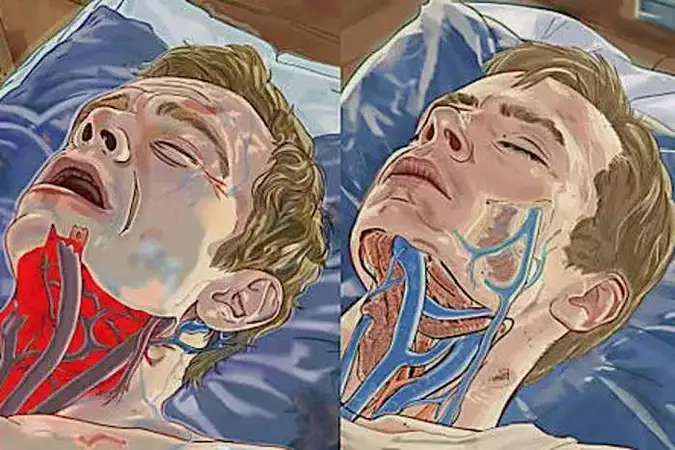 Sleep Apnea? This Simple Pillow Trick Is Turning Heads
