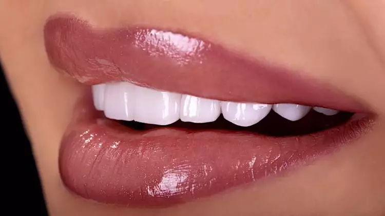 2023年的植牙費用可能使您驚訝 2023年的植牙費用可能使您驚訝