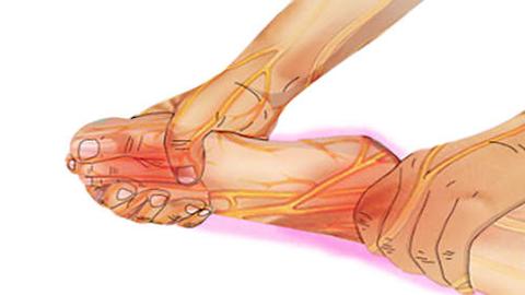 Simple Method to Reduce Neuropathy