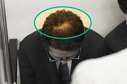 「頭皮が透けて見えたら…」バスクリンが快挙！有効成分生薬100%の育毛剤を開発