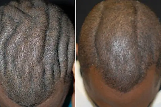 When You See A Man With A Wrinkled Head This Is What It's Means When You See A Man With A Wrinkled Head This Is What It's Means