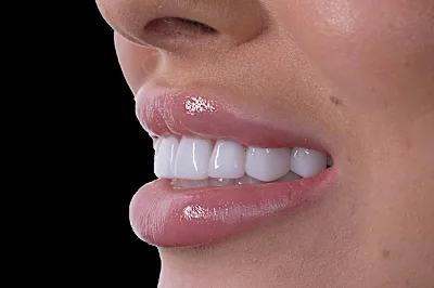 Attica: Χρειάζεστε οδοντικά εμφυτεύματα αλλά δεν έχετε χρήματα; Δείτε τις επιλογές