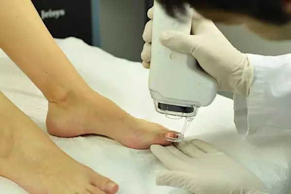 Ξέρεις πώς φεύγουν οι μύκητες από τα νύχια; Ξέρεις πώς φεύγουν οι μύκητες από τα νύχια;