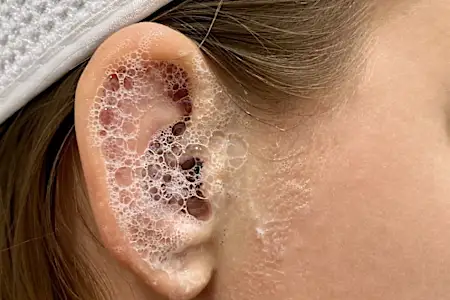 Doctor: If You Have Tinnitus (Ear Ringing) Do This Immediately! (Stop Doing This)!