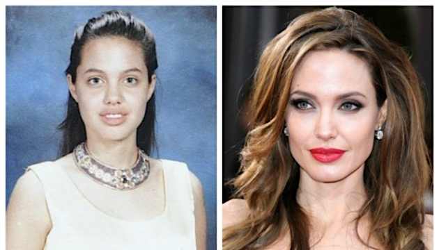 Jolie: brutta prima e bella oggi