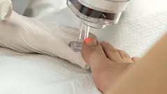 Μάθε πώς φεύγουν οι μύκητες από τα νύχια Μάθε πώς φεύγουν οι μύκητες από τα νύχια