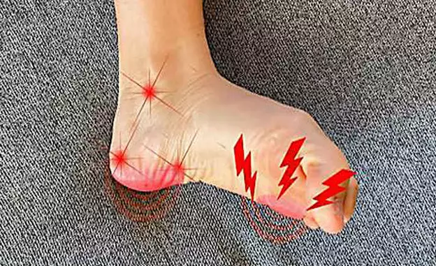 Neuropathy and nerve damage? Try this immediately