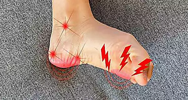 Neuropathy and nerve damage? Try this immediately