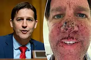 Ex-Sen. Ben Sasse on the ‘nasty drug’ for Stage 4 cancer that makes him ‘bleed out of a whole bunch of parts’