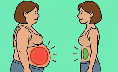 The UK doctor reveals: “The main reason for a big belly is not the calories...” The UK doctor reveals: “The main reason for a big belly is not the calories...”