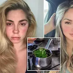 Kratom is a legal $13 ‘natural’ high that’s led to addiction and 91 deaths: ‘Soccer moms are on it’