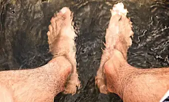 Do This if You Have Toenail Fungus (Try Tonight)