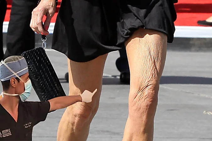 Dermatologist: The Best Way To Reduce Cellulite After 50 (It's Genius)