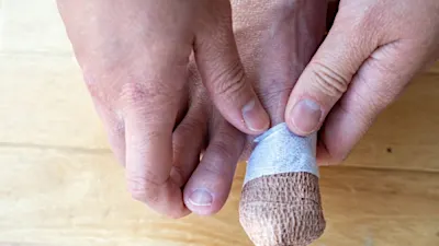 Doctor: Easiest fungus treatment ever can Vanish Toenail Fungus in a Few Days