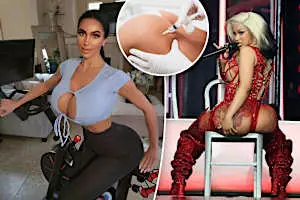 Model dies from illegal ‘liquid BBL’ — what to know about the risky procedure that left Cardi B in the ‘craziest pain ever’