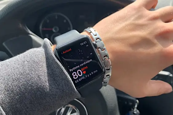 Αυτό το ρολόι εκπλήσσει ολόκληρη τη χώρα. Η τιμή? Γελοίος! (μόνο 69 $) Αυτό το ρολόι εκπλήσσει ολόκληρη τη χώρα. Η τιμή? Γελοίος! (μόνο 69 $)