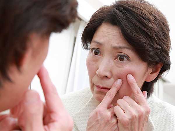 「目の下の膨らみ」をなおしたい人必見!簡単で安心な必見アイテムとは