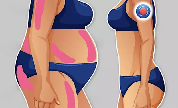 Kardiologe: Ein Pflaster täglich – und Ihr Bauchfett beginnt zu schmelzen!