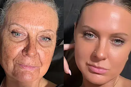 Plastic Surgeons Reveal: Forget Collagen, Use This Household Item.