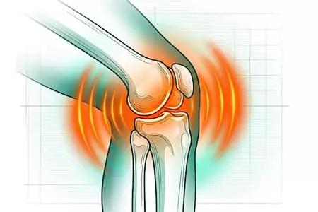 Knee pain is not caused by cartilage wear. Know the real enemy