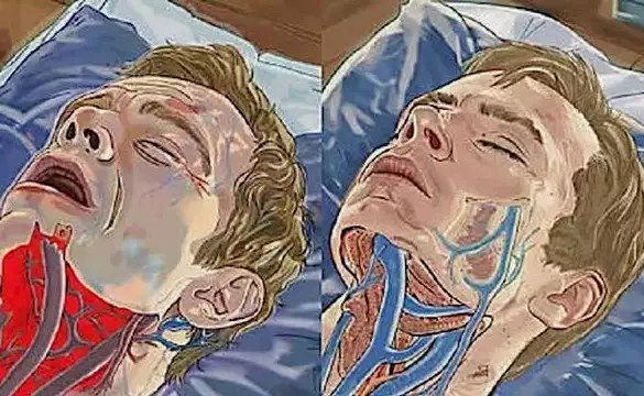 Apnée du sommeil : un oreiller ingénieux fait fureur au France