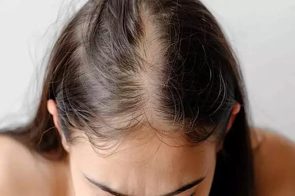 Ξέρεις πώς να επαναφέρεις τον όγκο στα μαλλιά σου; Ξέρεις πώς να επαναφέρεις τον όγκο στα μαλλιά σου;