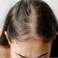 Ξέρεις πώς να επαναφέρεις τον όγκο στα μαλλιά σου; Ξέρεις πώς να επαναφέρεις τον όγκο στα μαλλιά σου;