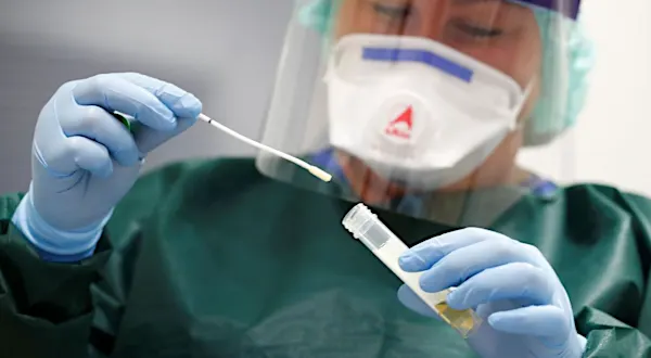 Ceará investiga 183 casos de pessoas que testaram positivo para Covid-19 duas vezes