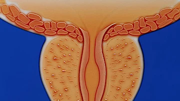 Urologist: Swollen Prostate? Do This If You're Over 40 (Men Only)