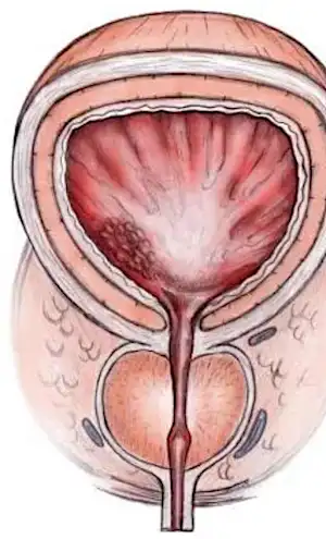 Prostate: If You Pee More Than 2x at Night, Do This Immediately! Prostate: If You Pee More Than 2x at Night, Do This Immediately!