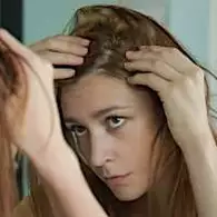 Ξέρεις πώς να σταματήσεις έγκαιρα την τριχόπτωση;