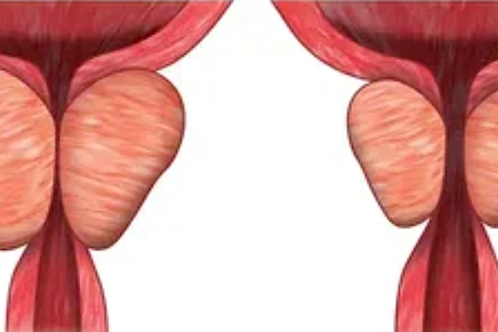 Enlarged Prostate Has Nothing to Do with Age. Just Stop Doing This One Common Thing!