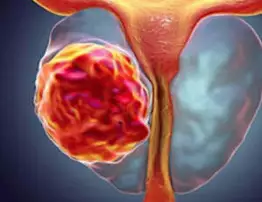 Urologist: Do this once a day to shrink enlarged prostate gland