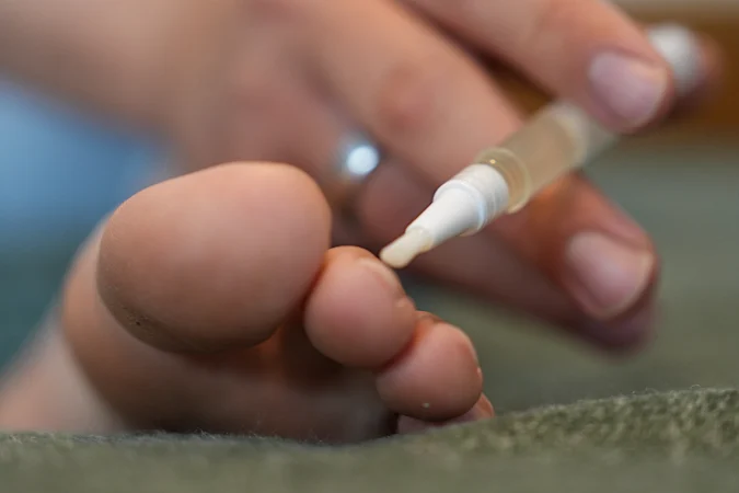 Fungus is Not from Toe Infection! Meet the Main Enemy of Fungus (Stop Doing This)