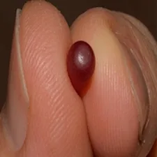 Urologist: Enlarged Prostate? Do This Immediately (Genius!)