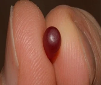 Urologist: Enlarged Prostate? Do This Immediately (Genius!)