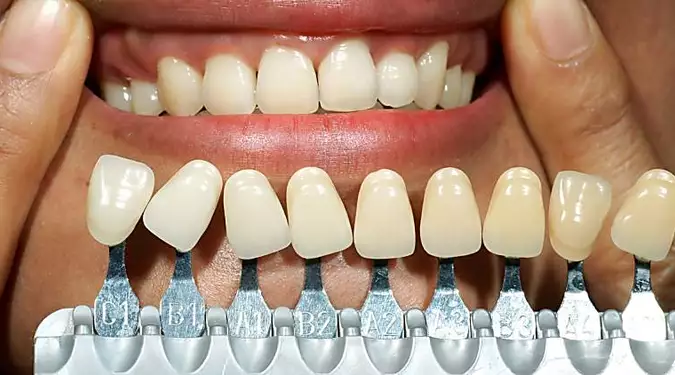 The Actual Price of Whole Mouth Dental Implants In Spain. See The List