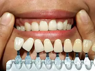 Need Dental Implants But Have No Money? See More