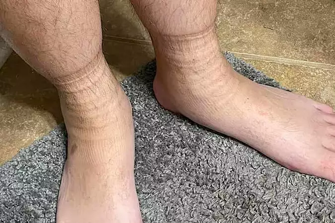 Μουδιασμένα πόδια; Αυτό είναι το πιο απλό κόλπο που οι γιατροί δεν σας αποκαλύπτουν