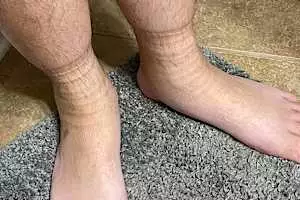 Neuropathy is Not From Low Vitamin B. Meet The Real Enemy of Neuropathy