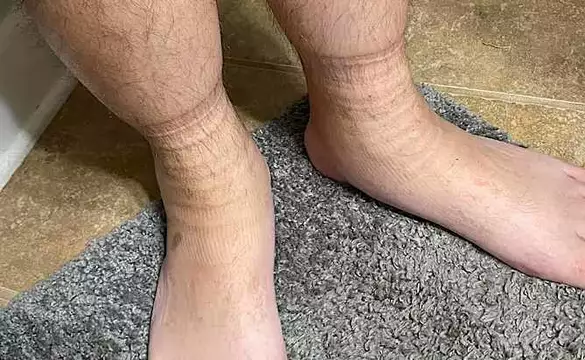 La thérapie idéale contre la neuropathie à la maison (c’est brillant !)