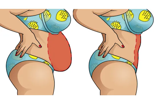 These tummy slimming patches are all the rage