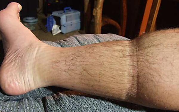 זו הגרב המהפכנית לאנשים עם רגליים נפוחות שמשפרת את זרימת הדם
